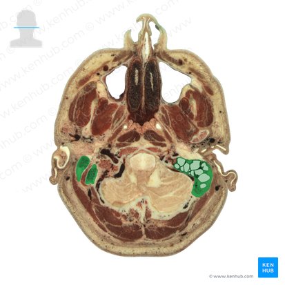 Mastoid process of temporal bone (Processus mastoideus ossis temporalis); Image: National Library of Medicine