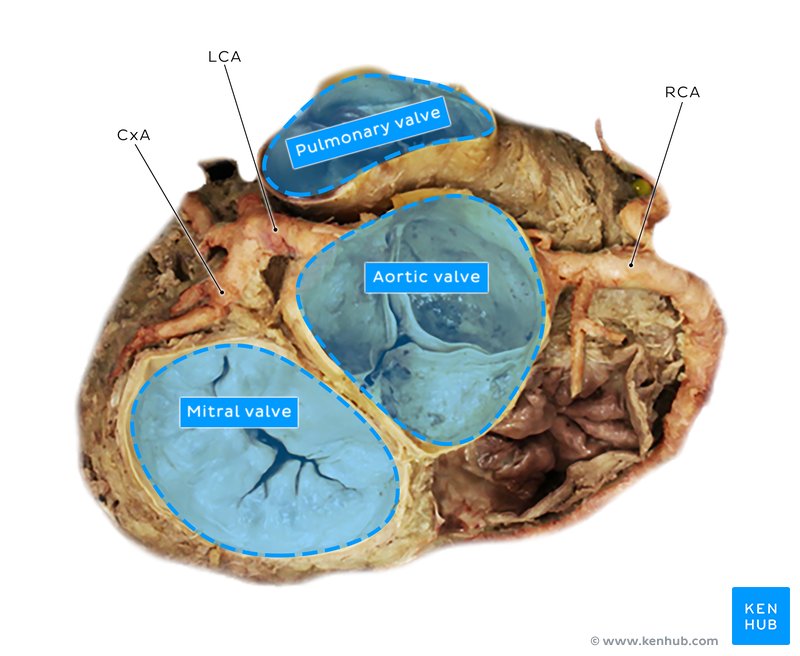 Cadaver image of the coronary arteries - superior view