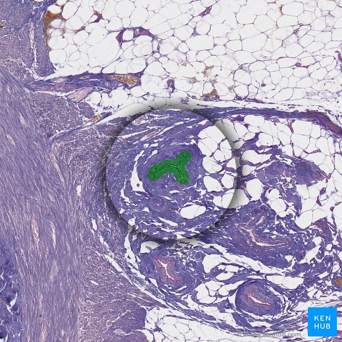 Rama de la arteria apendicular (Ramus arteriae appendicularis); Imagen: 