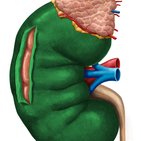 Renal capsule