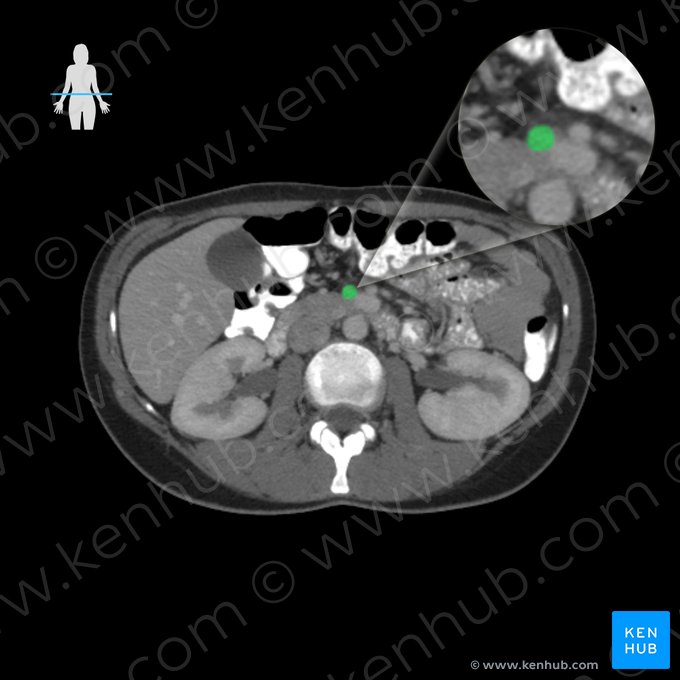 Superior mesenteric vein (Vena mesenterica superior); Image: 