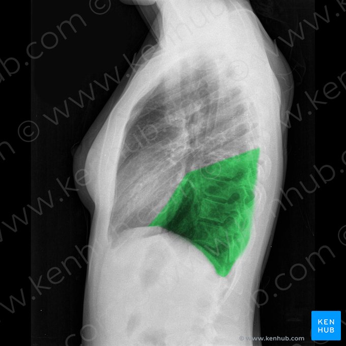 Lobo inferior do pulmão direito (Lobus inferior pulmonis dextri); Imagem: 