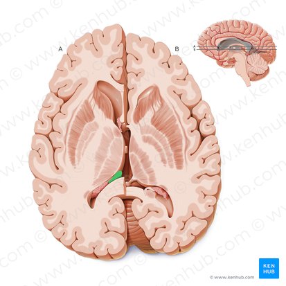 Crus of fornix (Crus fornicis); Image: Paul Kim