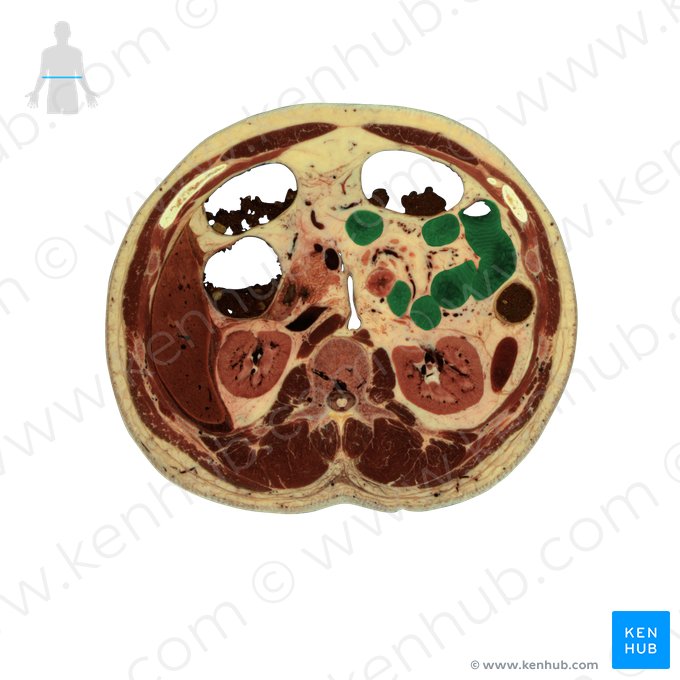 Jejunum (Leerdarm); Bild: National Library of Medicine