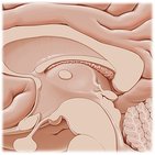 Choroid plexus