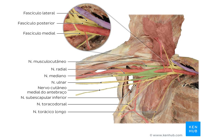 Anatomia do plexo braquial visualizada em um cadáver.