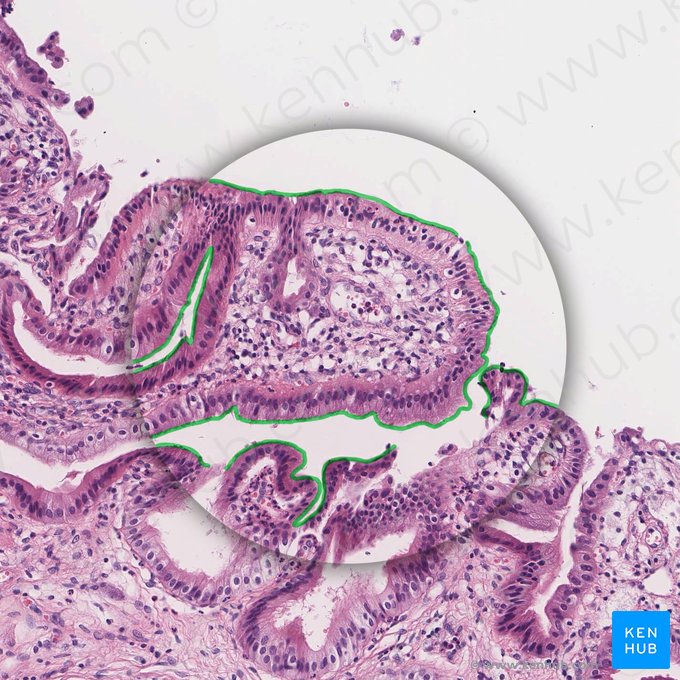 Microvilosidades (Microvilli); Imagem: 