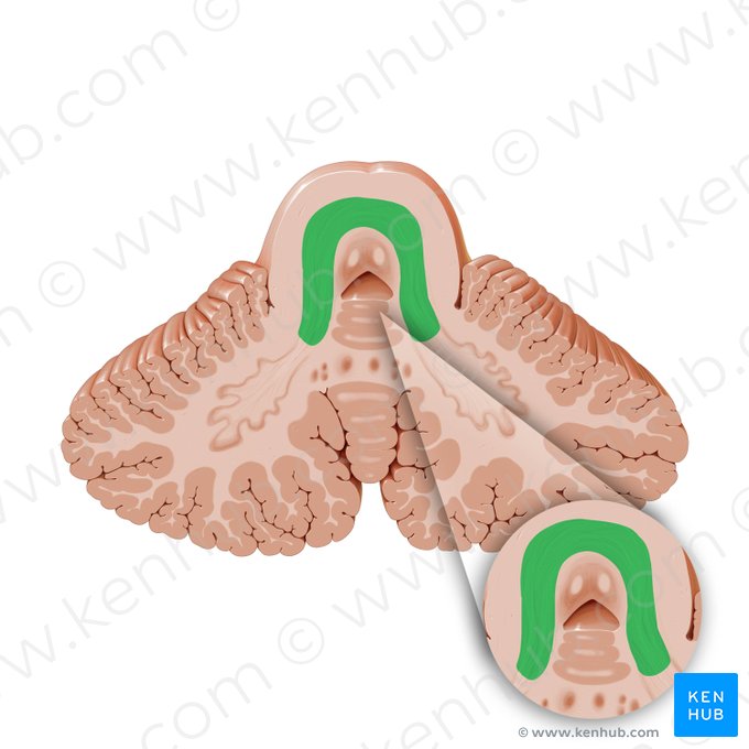 Pedunculus cerebellaris superior (Oberer Kleinhirnstiel); Bild: Paul Kim