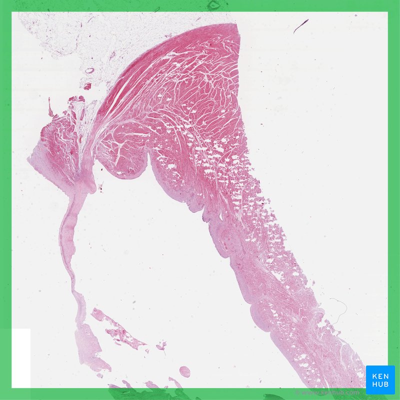 Heart - histological slide