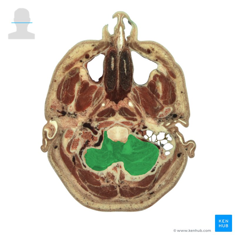 Cerebellum - cross-sectional view
