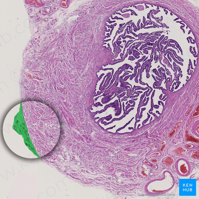 Peritoneum; Image: 