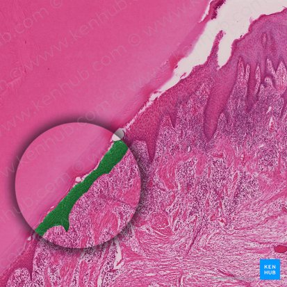 Junctional epithelium; Image: 